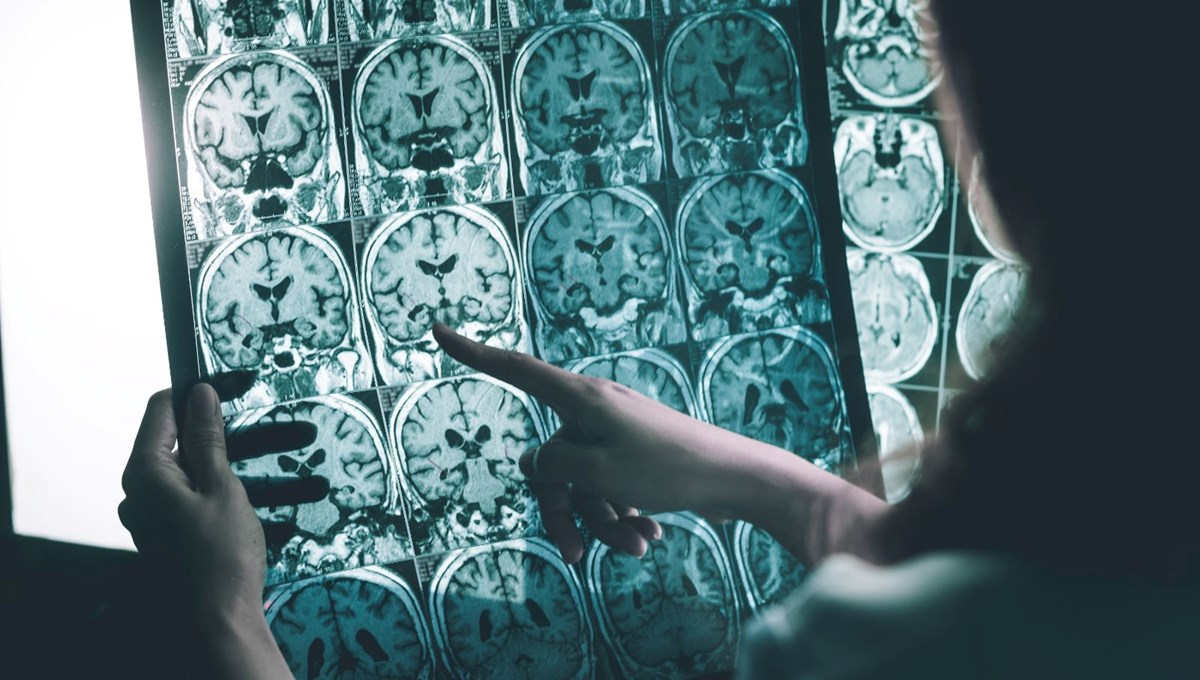 Stresli işlere karşı elektronik dövme: Fazla çalışınca alarm veriyor