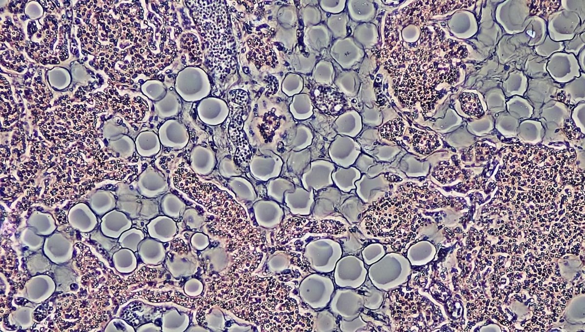 Laboratuvarda ilk canlı insan derisi geliştirildi