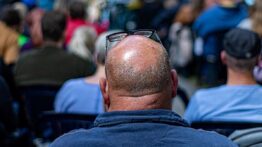 Saç dökülmesinde yeni umut: 20 günde etkisini gösterdi