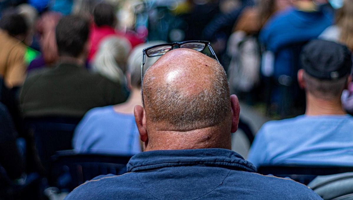 Saç dökülmesinde yeni umut: 20 günde etkisini gösterdi